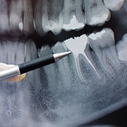 Head and Neck X-Ray